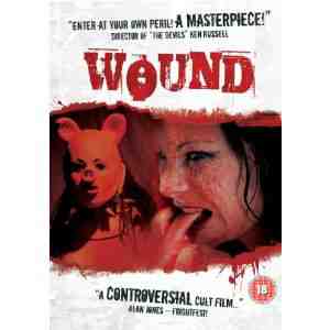 Wound DVD Kate ORourke