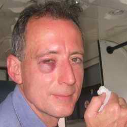 Peter Tatchell